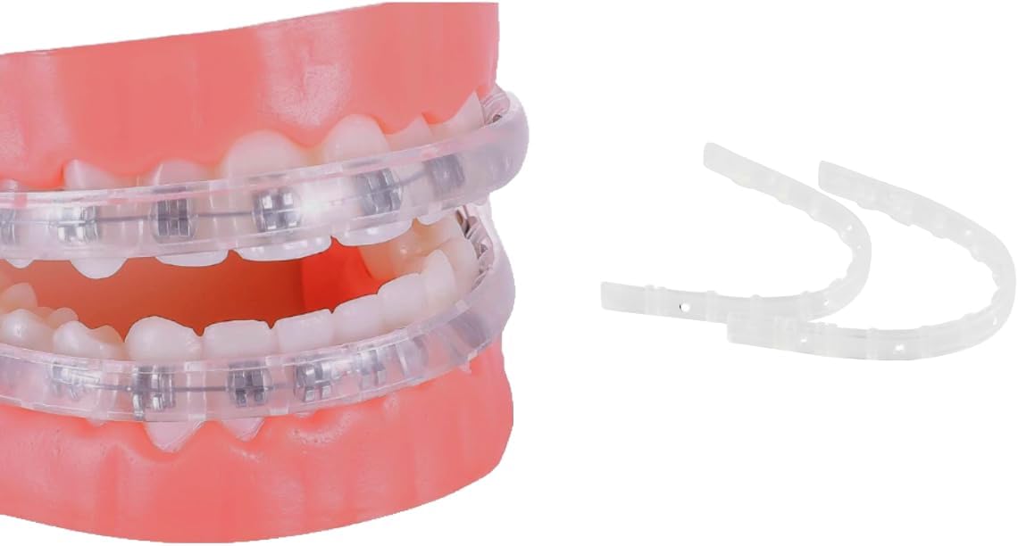 Lip Protector for Braces, Orthodontic Mouth Guard for Braces, Wax Alternative, Comfort Covers for Braces, Lip Shield for Brackets, Lip Bumper for Braces