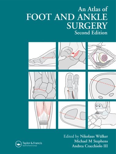 Atlas Foot and Ankle Surgery, Second Edition by Nikolaus W�lker (Editor), Michael Stephens (Editor), Andrea C. Cracchiolo (Editor) (14-Jul-2005) Hardcover