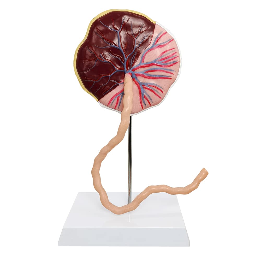 Placenta Umbilical Cord Anatomical Model, Life Size Umbilical Cord Placenta Model with Veins Arterial Embryo Tissue Structure for Obstetrics and Gynecology Teaching Tool with Base