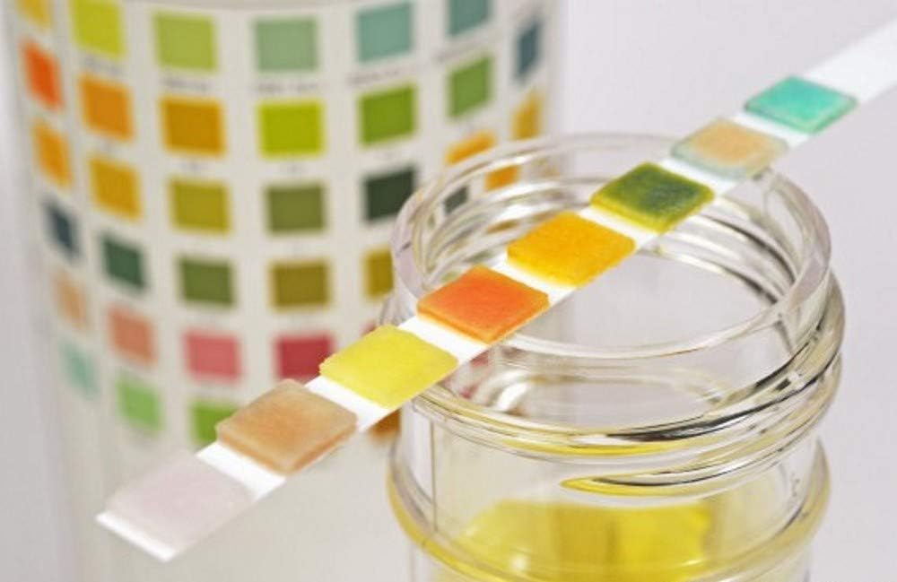 25 x Urine Test Strips 10 Parameter Urinalysis Testing Kit Multisticks Urine Strip Stick - pH, Glucose, Ketone, Liver, Kidney & UTI