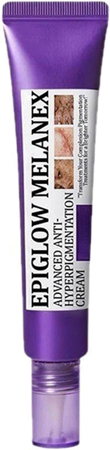 Hyperpigmentation Treatment Cream,Anti Pigmentation Removal Cream，Dark Spot Remover for Face,Face Cream for Melasma Hyperpigmentation, Spot Treatment for All Skin Type