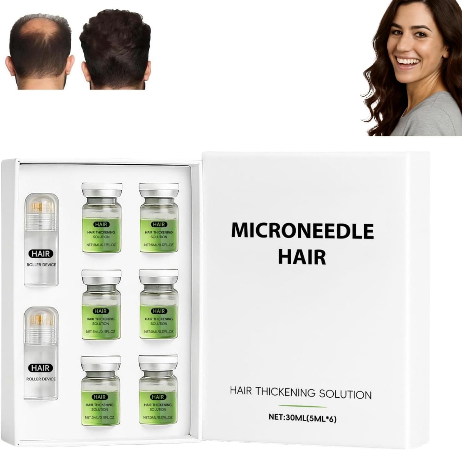 Alphainfuse Hair Regrowth System, Microneedle Infusion Hairregrowth Solution, Microneedling Hair Growth Serum, For Hairs Loss Thinning, Enhances Thick Hairs for Men Women