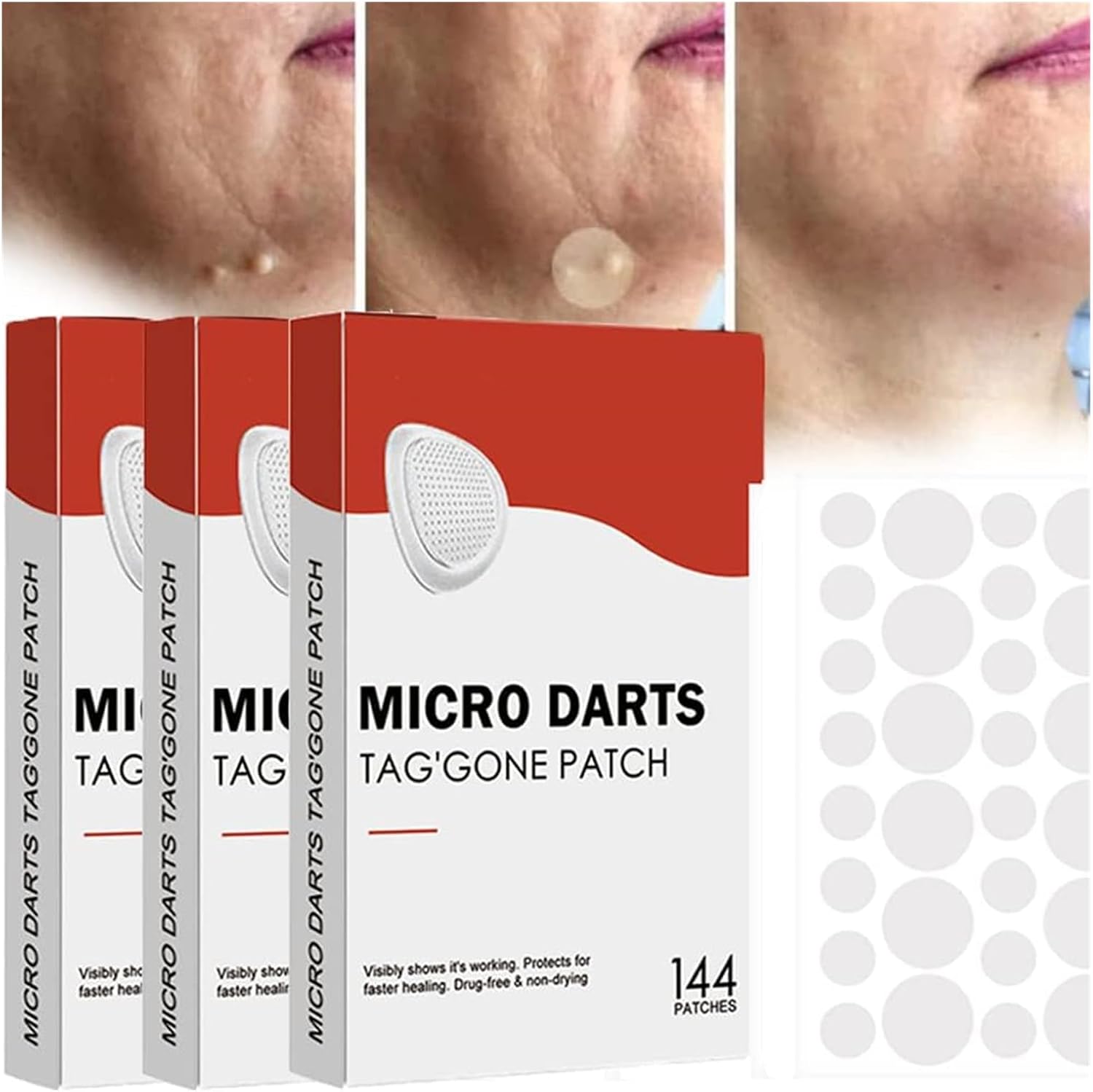 Nihexo Microdarts Tag'gone Patch, 144Pcs/box (3 Box), Face & Body, Anti-Acne, Skin Care Patch