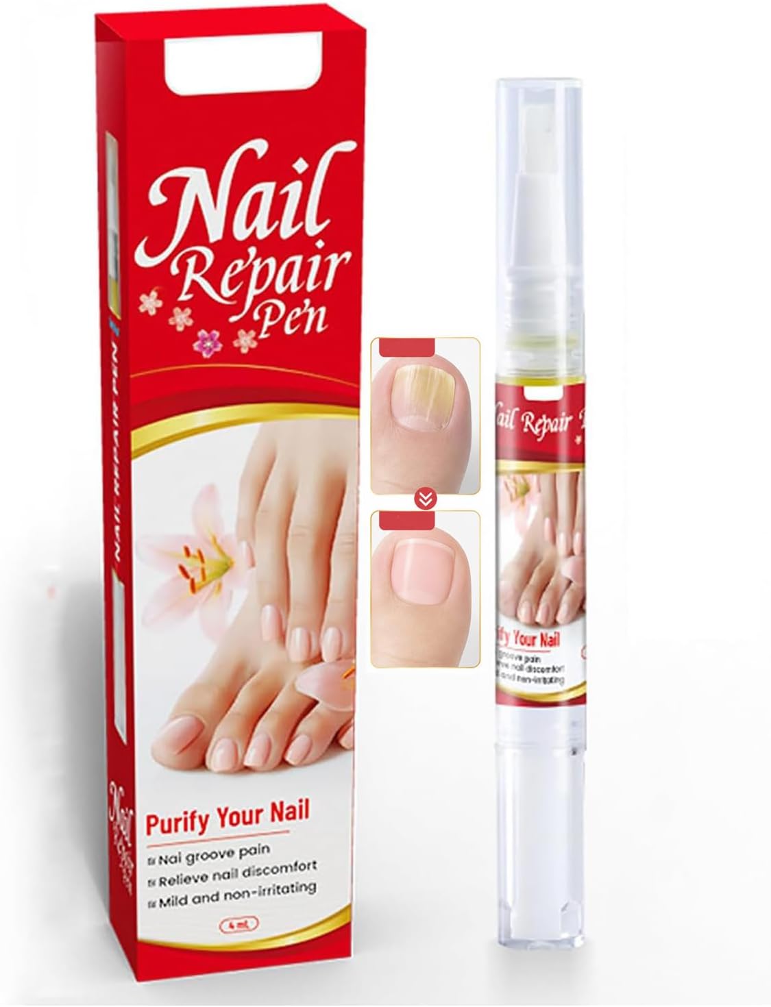 Nail Fungus Pen Extra Strength for Toenail & Fingernail, Precise Brush Applicator for Daily Nail Care, Supports Natural Appearance, Easy-Apply Care Formula Pen (4ML)