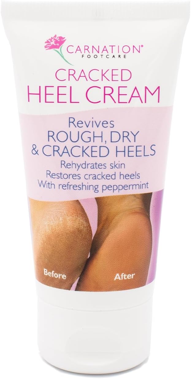 CARNATION FOOTCARE Cracked Heel Cream, Revives Rough, Dry and Cracked Heels, Moisturises, Rehydrates Dry Callused Feet with Refreshing Peppermint Oil with 20% Urea, 50ml