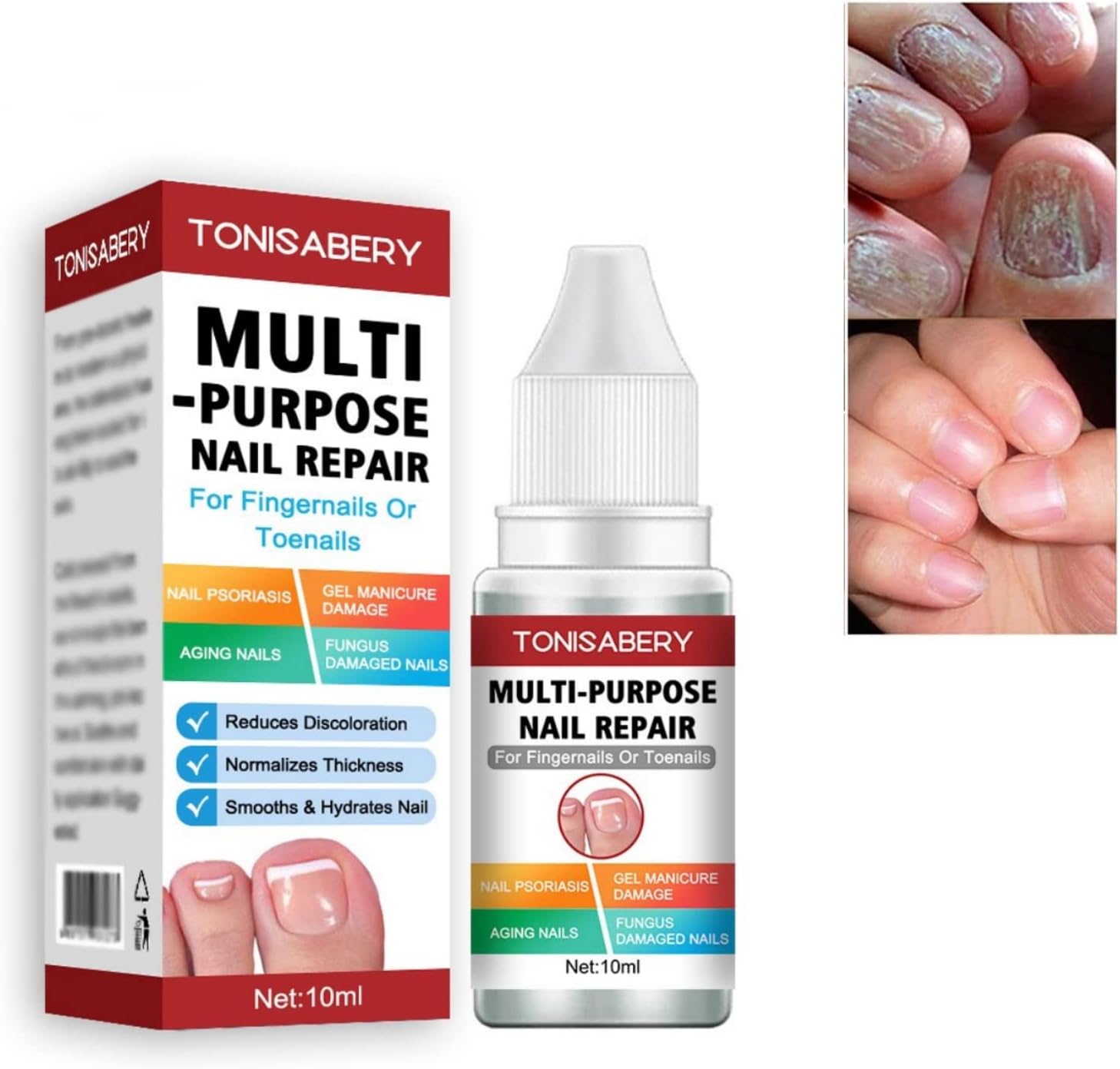AINxtolm Fungal Nail Treatment,Nail Fungus Treatment Toenail,Toe Nail,Toenail Fungus Treatment,Fungal Nail Treatment Toenails Extra Strong,Fingernail Toenail Care Nail Repair, red, 10 millilitre