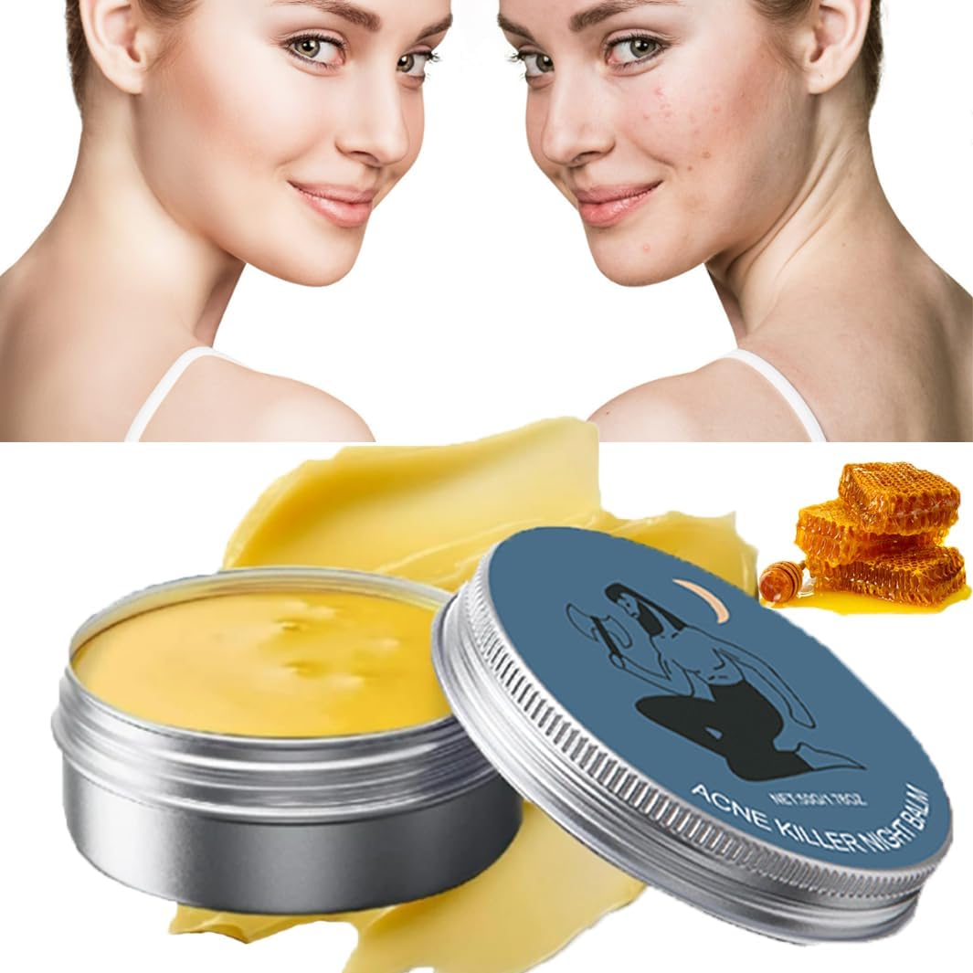 Norse Acne Organics Balm Cream，Norse Organics Acne Balm,Organics Acne Killer,Norse Organics Acne & Redness Killer,Norse Acne Set Clearing Cream for Women & Men, Ultra-Performance Skincare