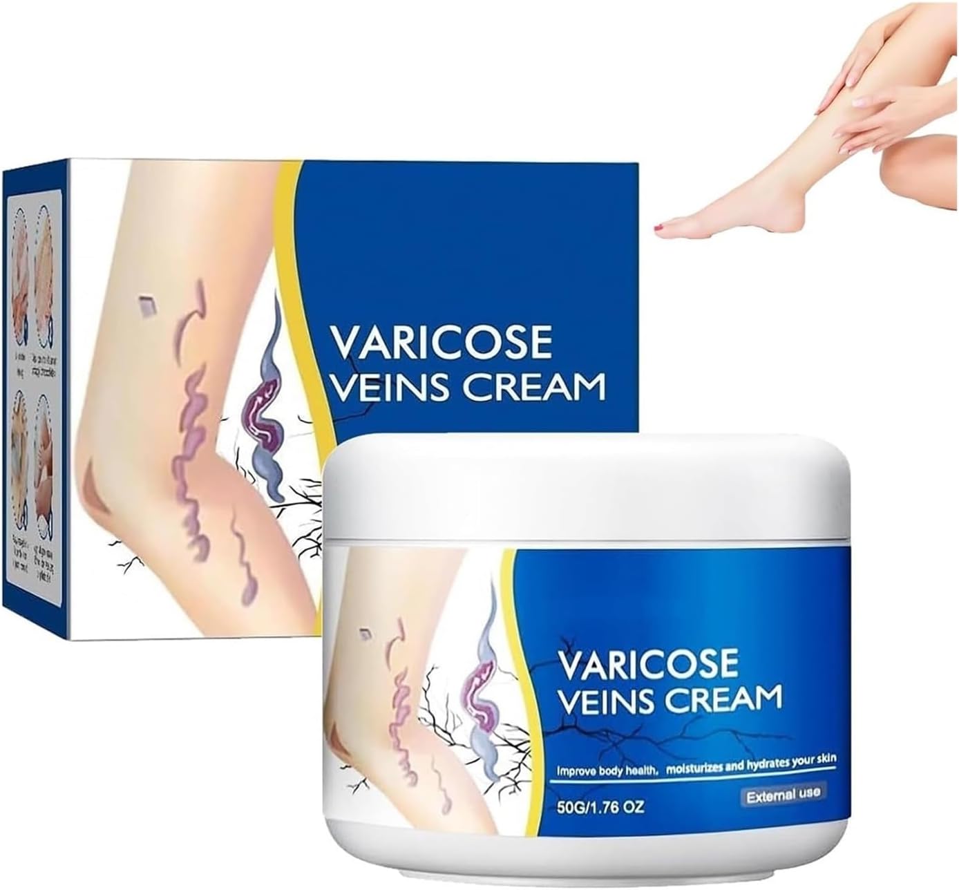 Varicose Veins Cream(1PCS)