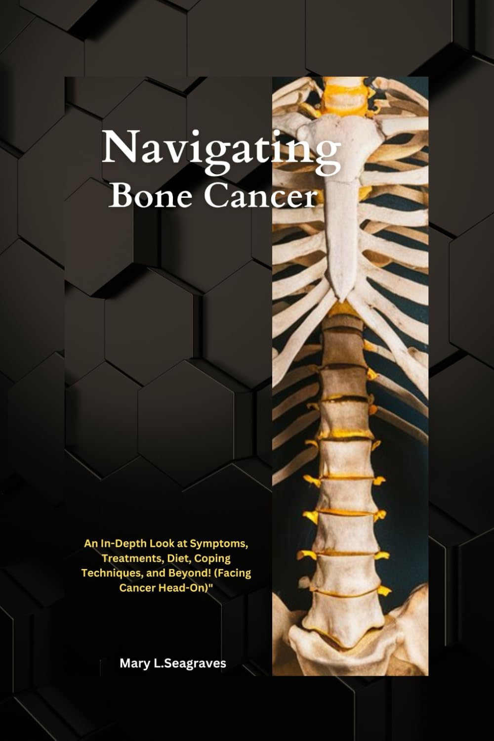 Navigating Bone Cancer: : An In-Depth Look at Symptoms, Treatments, Diet, Coping Techniques, and Beyond! (Facing Cancer Head-On)" (On This Facing Cancer Series)