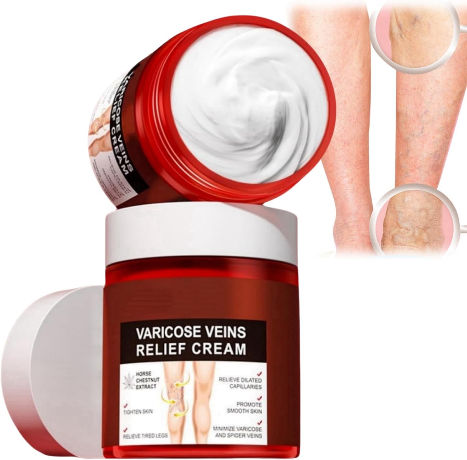 80g Varicose Veins Relief Cream,Varicose Veins Treatment Cream for Legs,Varicose Veins Treatment,Varicose Vein Treatment
