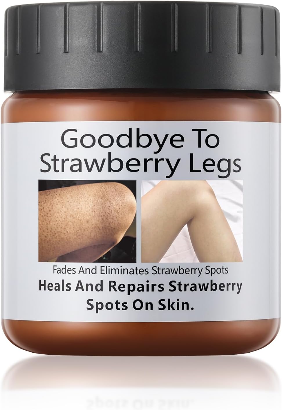 Strawberry Legs Treatment, Skin Smoothing Cream for Chicken Skin Treatment, Fades And Eliminates Strawberry Spots, Exfoliating, Moisturizing, 4.21fl.oz/120g