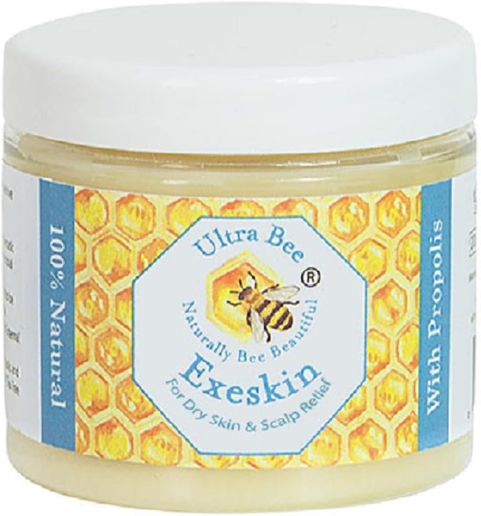 100% Natural Exeskin Balm 200ml - Soothes Dry Sensitive Skin and Dry Itchy Scalp - Also Suitable for People Prone to Eczema Psoriasis, Dermatitis, Rosacea