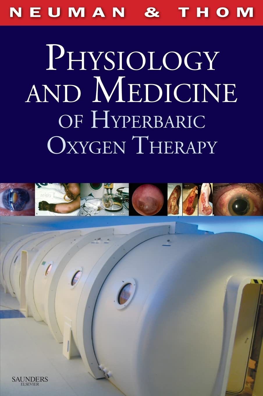 Physiology and Medicine of Hyperbaric Oxygen Therapy