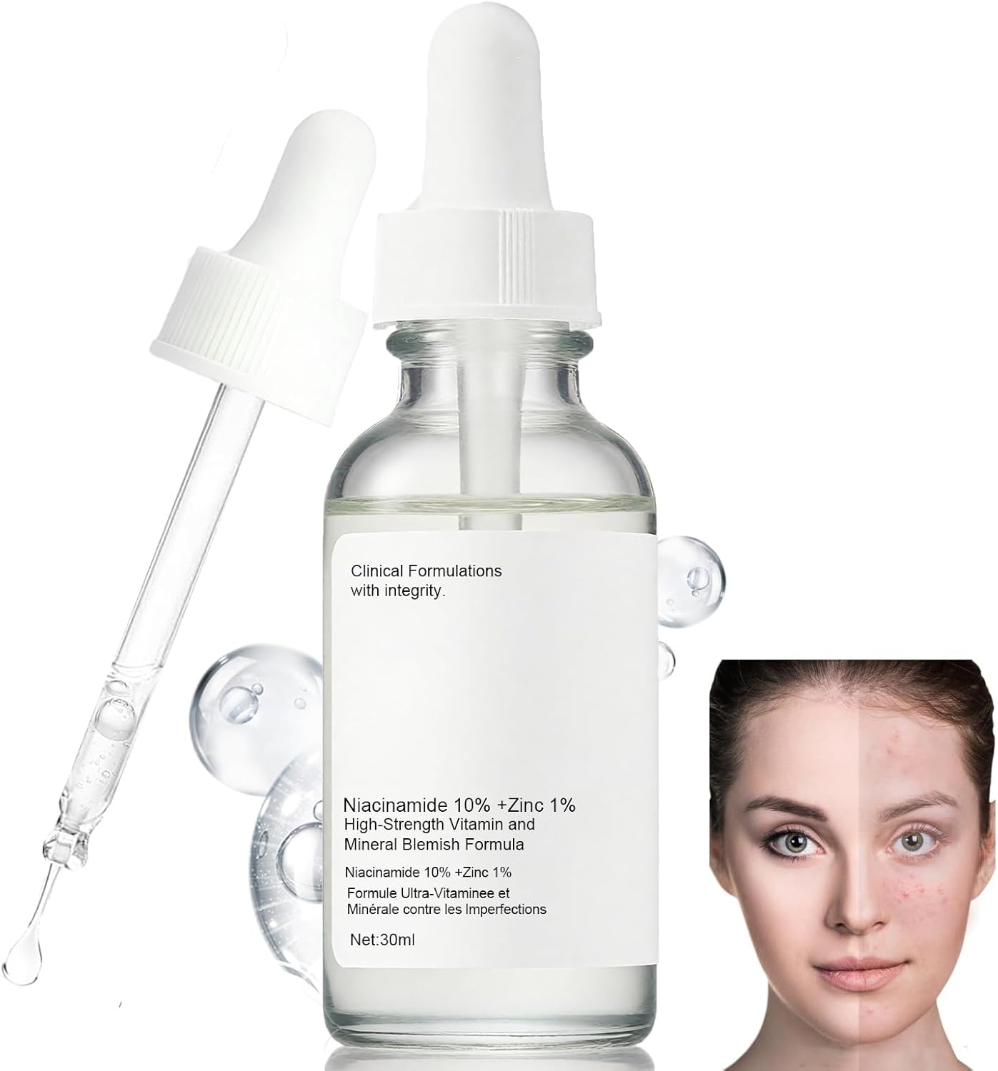 Niacinamide10%+Zinc 1%, Face moisturizer, Pore Reducer Face Serum,Tackles Blemishes, Niacinamide Serum for Blemish-Prone,Dull Skin,Softens, Balancing Sebum Production,Hydrating