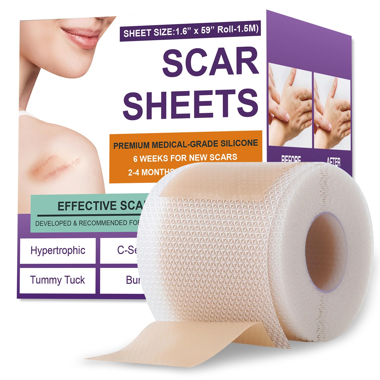 Silicone Scar Sheets,Silicone Scar Tape,Scar Tape For Surgical Scars,Silicone Scar Removal Strips For Surgical,C-Section,Tummy Tuck,Keloid Scars(1.6"X 59" Roll-1.5M) Keloid Bump Removal
