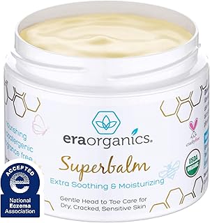 Era Organics Healing Ointment for Babies - USDA Certified Organic Natural Gentle Moisturizer for Sensitive Skin Prone To Baby Eczema, Cradle Cap (Infant Seborrheic Dermatitis), Rashes, Hives & More