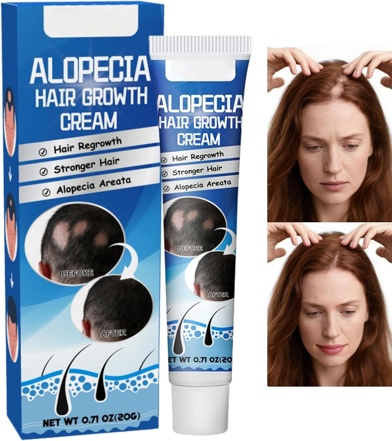 20g Alopecia Hair Growth Cream,Scalp Nourishing Anti Hair Loss,Men and Women Hair Growth Serum,Hair Gr/owth Grease,Alopecia Hair Loss Treatment,Thinning Ha/ir Treatment for Women,Scalp Moisturizer