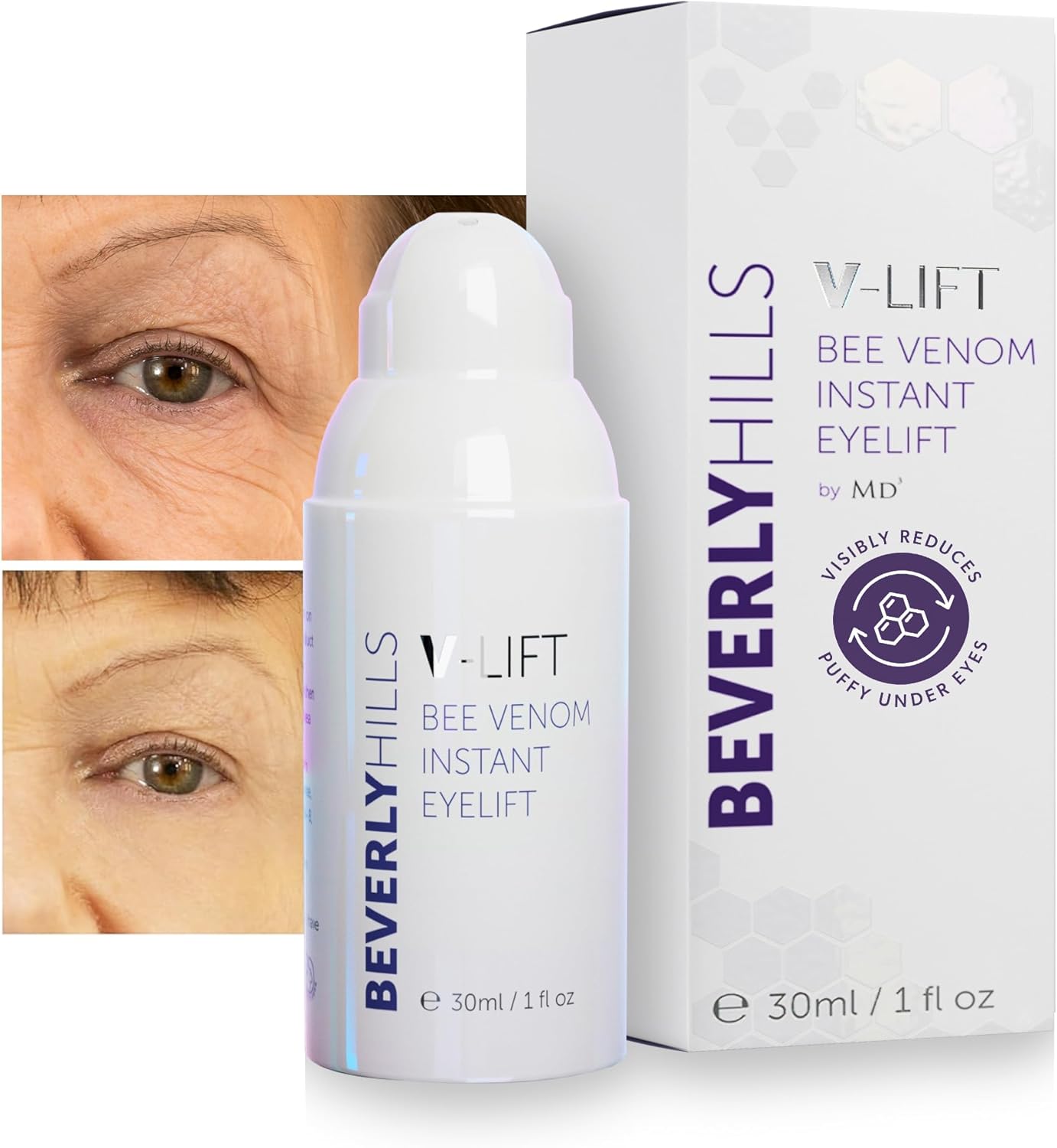 BEVERLY HILLS V-Lift Instant Eye Lift and Tuck Bee Venom Serum for Treating Puffy Eyes, Dark Circles, and Wrinkles