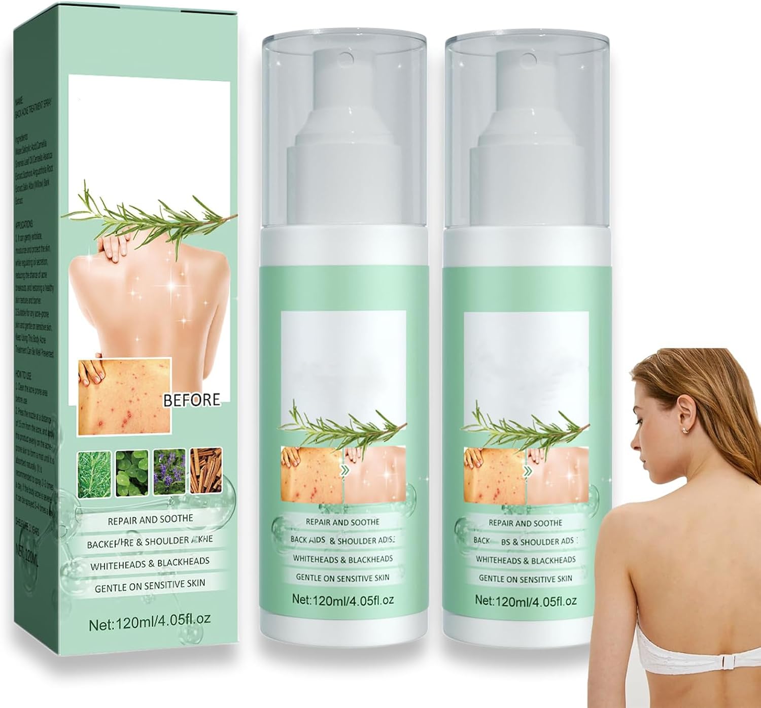 INSKIN Back Acne Treatment Spray, Visibly Reduces Spots and Redness (2pcs)
