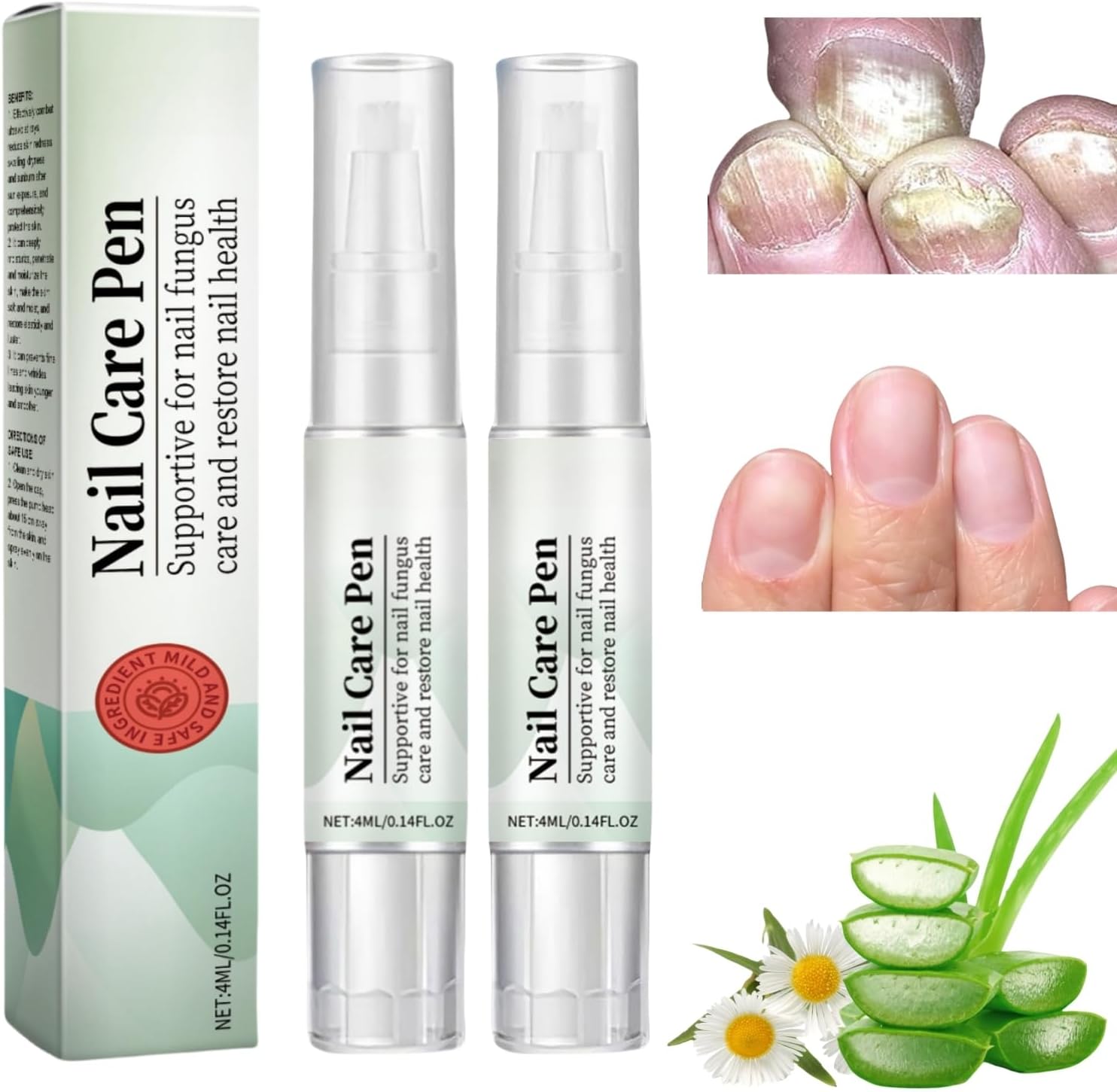 2PCS Nail Care Pen,Fungal Nail Treatment Pen,Cosmetic Care for Nail Fungus,Toenail Fungus Treatment Pen,Fungal Toenail Treatment,Antifungal Nail Polish,Nail Repair Pen for Nail
