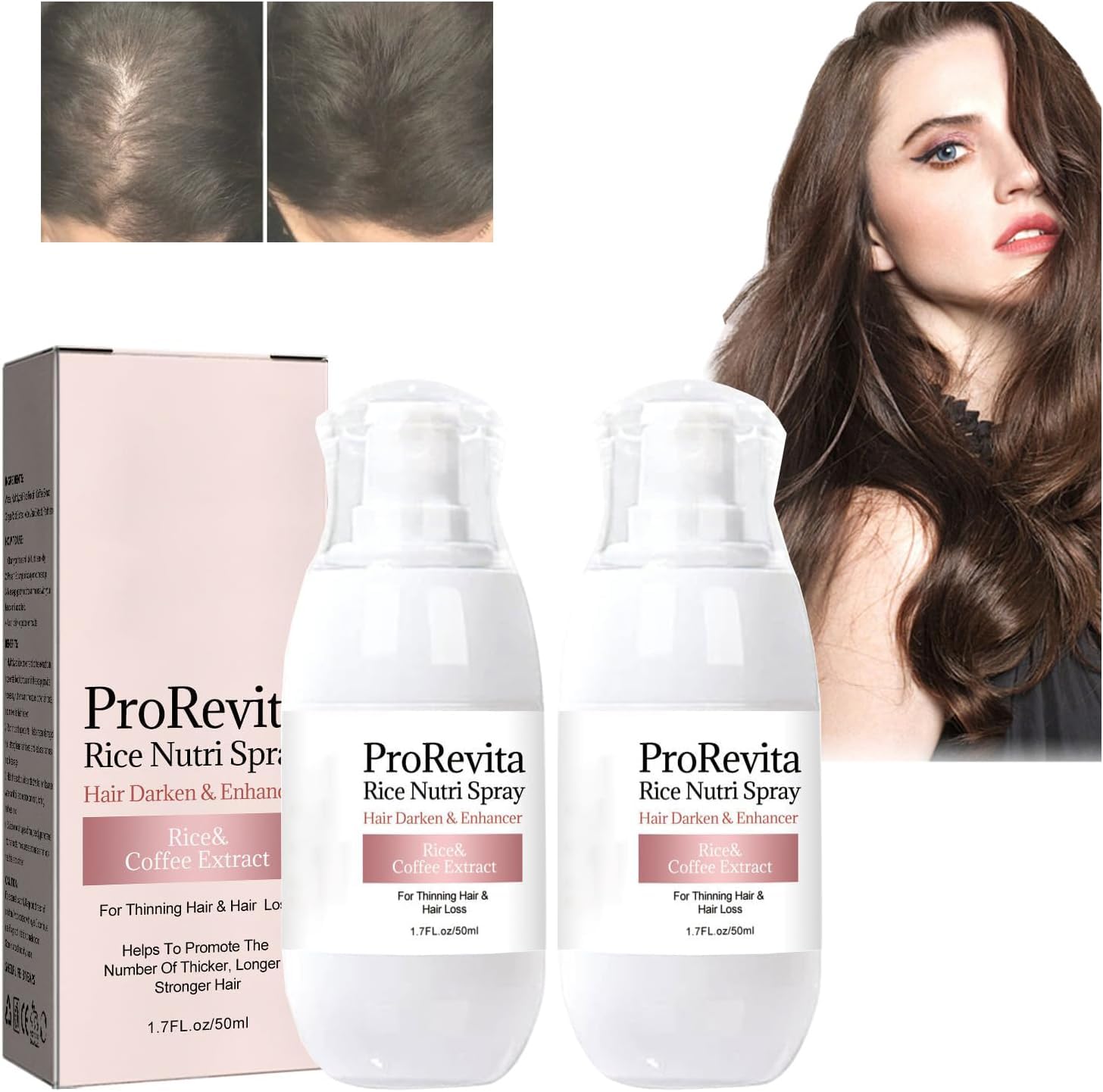 Zephta H-Regrow 2.0 - Zephta Hair Regrowth, H-Regrow 2.0, ProRevita Rice Nutri Spray, Hair Helper Spray, Hair Care Spray for Thinning Hair & Hair Loss, For All Hair Types (2PC)