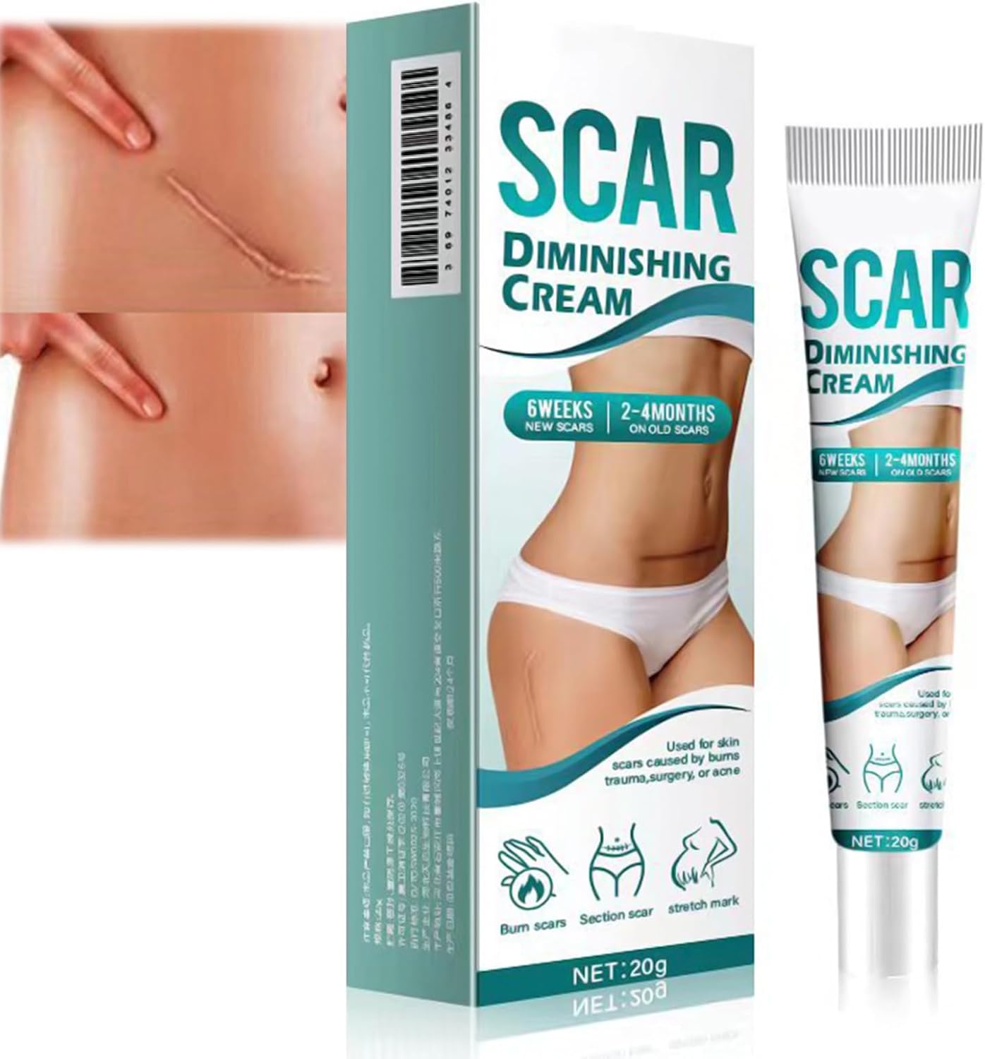 Scar Cream for Face & Body - Assists in Enhancing The Look of Stretch Marks, C - Section Scars, Surgical Scars - Suited for Old & New Scars - Facilitates Skin Restoration