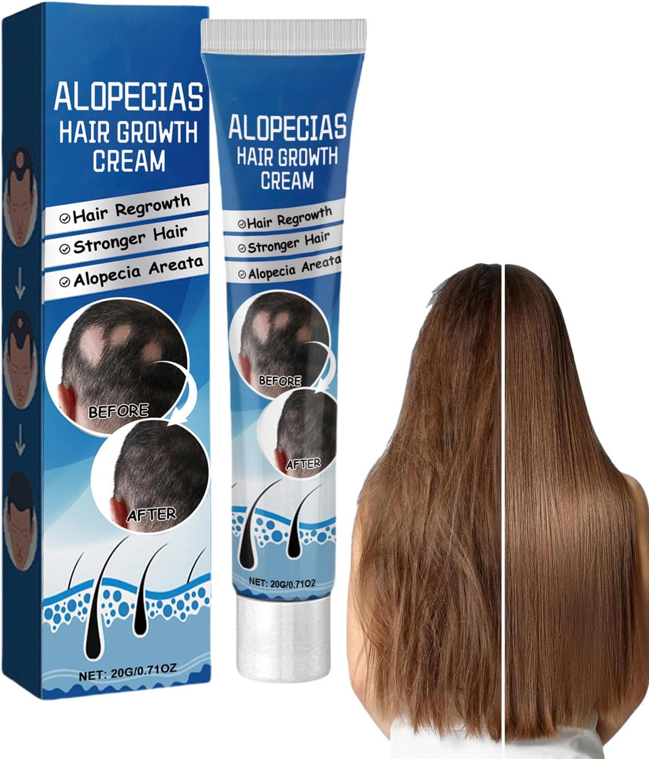 Alopecia Hair Growth Cream, Scalp & Hair Strengthening Cream, Lightweight And Non-Greasy Texture, Thickening Lightweight Moisturizer Paste For Daily Women Men Beauty, Reduces Breakage Naturally