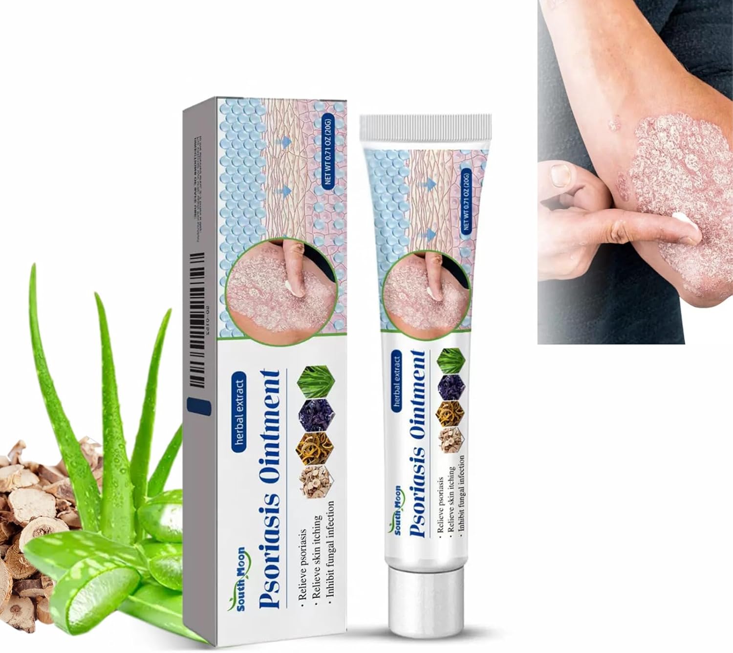 Antifungal Cream, Anti-fungal Skin Cream, Help to Treat Eczema, Beriberi, Tinea Cruris, Tinea, Quickly Relieve Itching, Chapped Skin and Fungal Infection, Skin Anti-fungal Cream 20g.