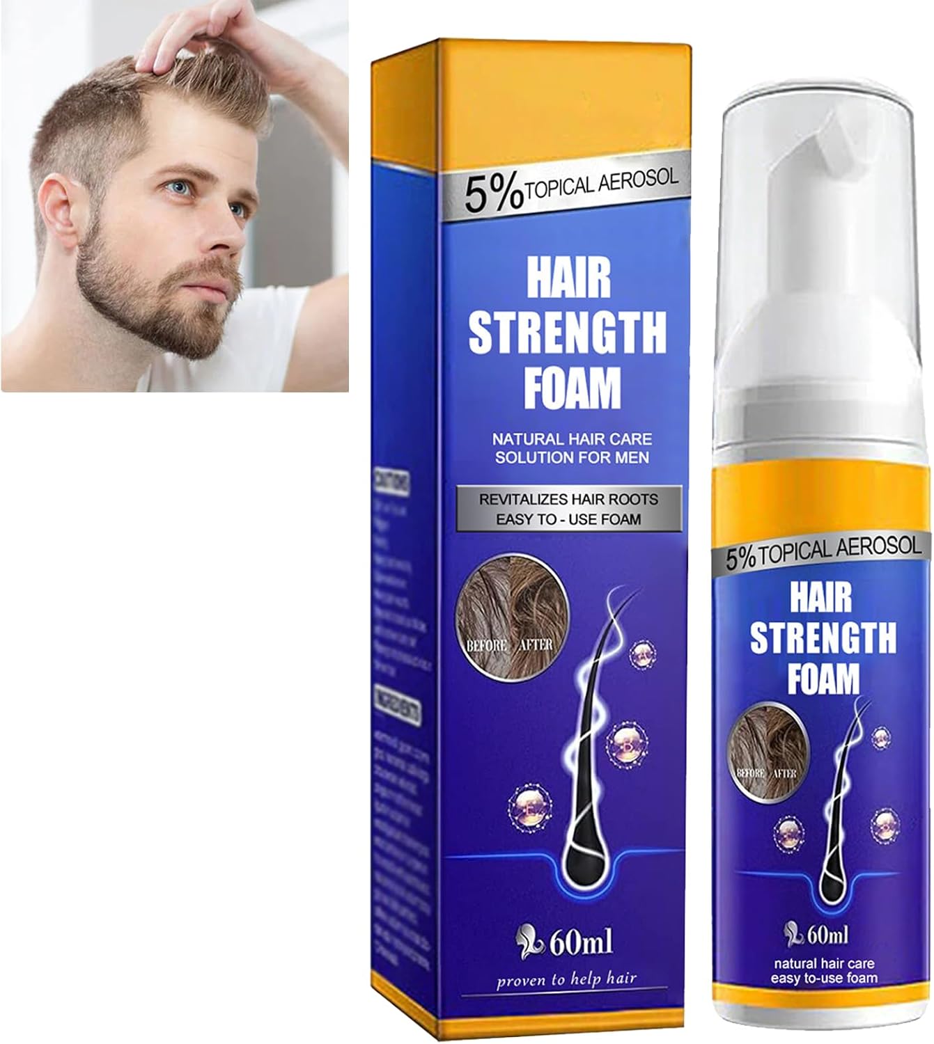KOAHDE Hair Regrowth Foam for Men,Hair Regrowth Spray Foam,Hair Growth Foam,Anti Hair Loss Foam,Thinning Hair Foam for Men,Hair Regrowth Treatment for Men,Hair Growth Serum for Men,Hair Loss Serum
