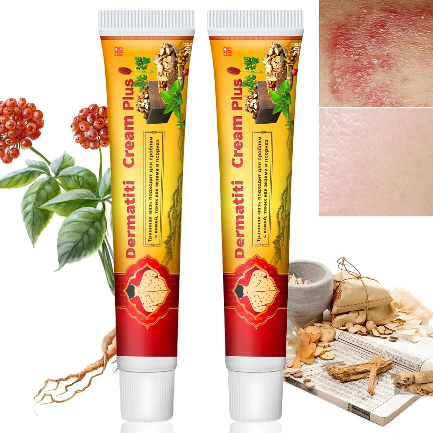 2Pcs Antifungal Cream Relieves Itchy Skin,Anti Fungal Skin Cream,Itch Relief Cream,Fungal Cream for Skin,Itchy Skin Relief for Adults,Anti Itching Cream for Skin,Fungal Cream,Antifungal Creams