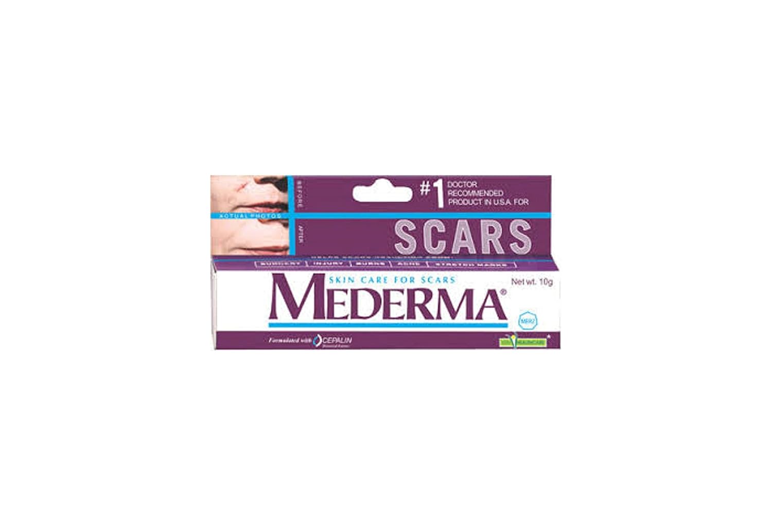 Mederma Skin Care Scar Gel 10Gm (0.35 oz.)