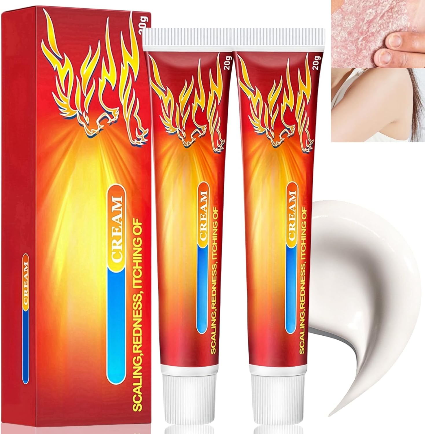 2Pcs Antifungal Cream Relieves Itchy Skin,Skin Repairing Cream for Face Body,Fungal Cream for Skin,Anti Fungal Skin Cream,Itch Relief Cream,Healthy Skin Treatment,Cream for Itchy Skin