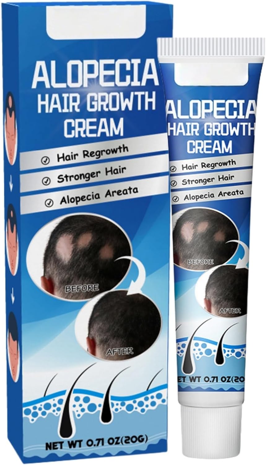 Alopecia Hair Growth Cream,Alopecia Treatment & Hair Loss Treatment,Hair Thickening Cream for Women & Men,Scalp Cre/am to Prevent H/air Loss,Thickening Paste for Alo/pecia,H/air Thinning Treatment