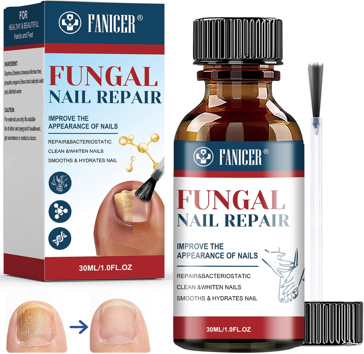 30ml Nail Treatment, Fast Extra Strong Nail Repair Solution, Nail Treatment Serum, Repair for Damaged Discolored Thick Nail, Repairs and Renew Damaged, Broken, Cracked & Discolored Nails