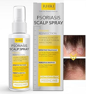 Psoriasis Scalp Spray | Dandruff Treatment for Scalp Yeast Infections, Psoriasis & Folliculitis | Antifungal & Ringworm Itchy Scalp Treatment Formula Spray for Dryness and Fungal Infections