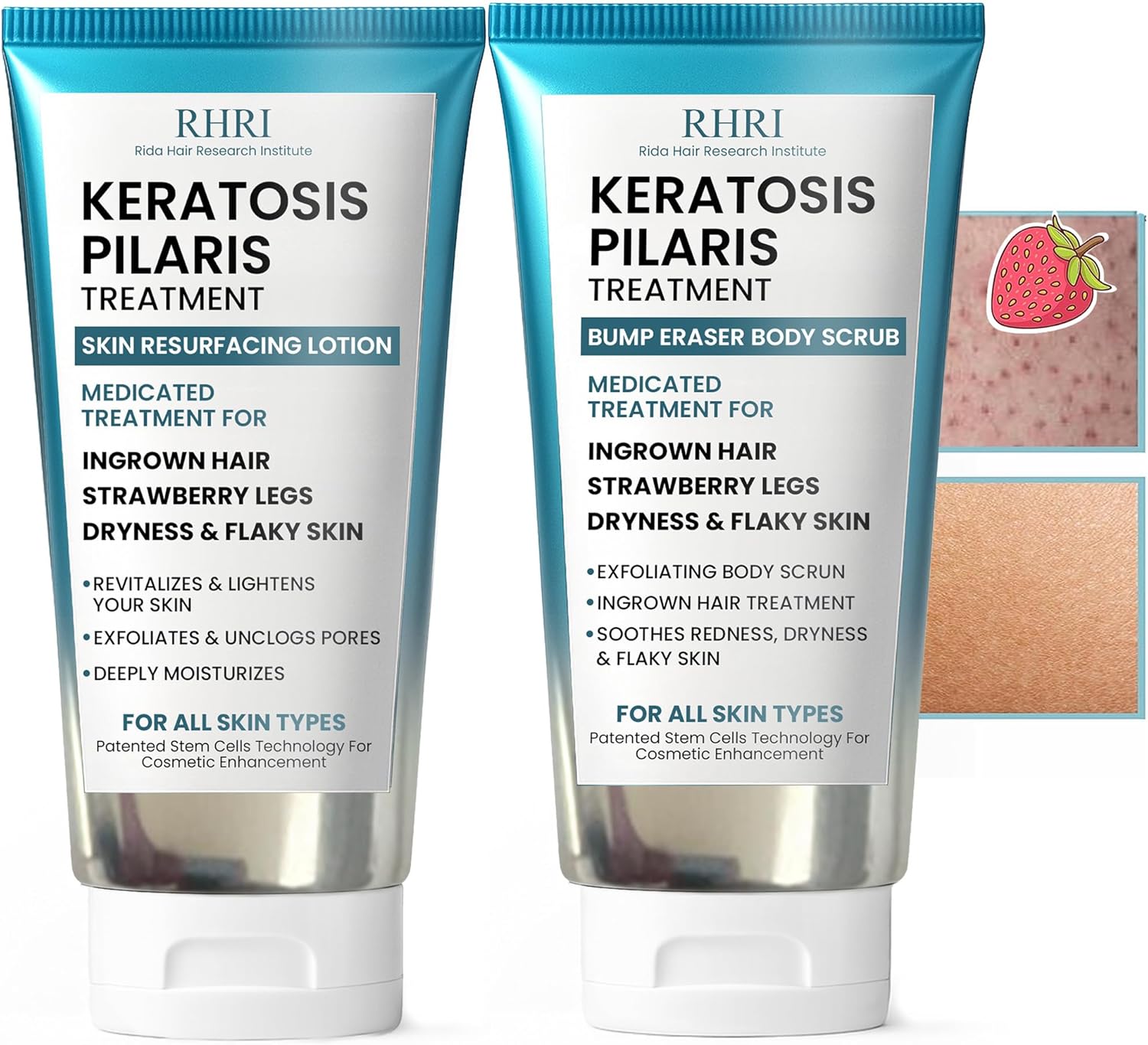 KP Bump Eraser Body Scrub Set + Keratosis Pilaris Leg Care Strawberry for Women