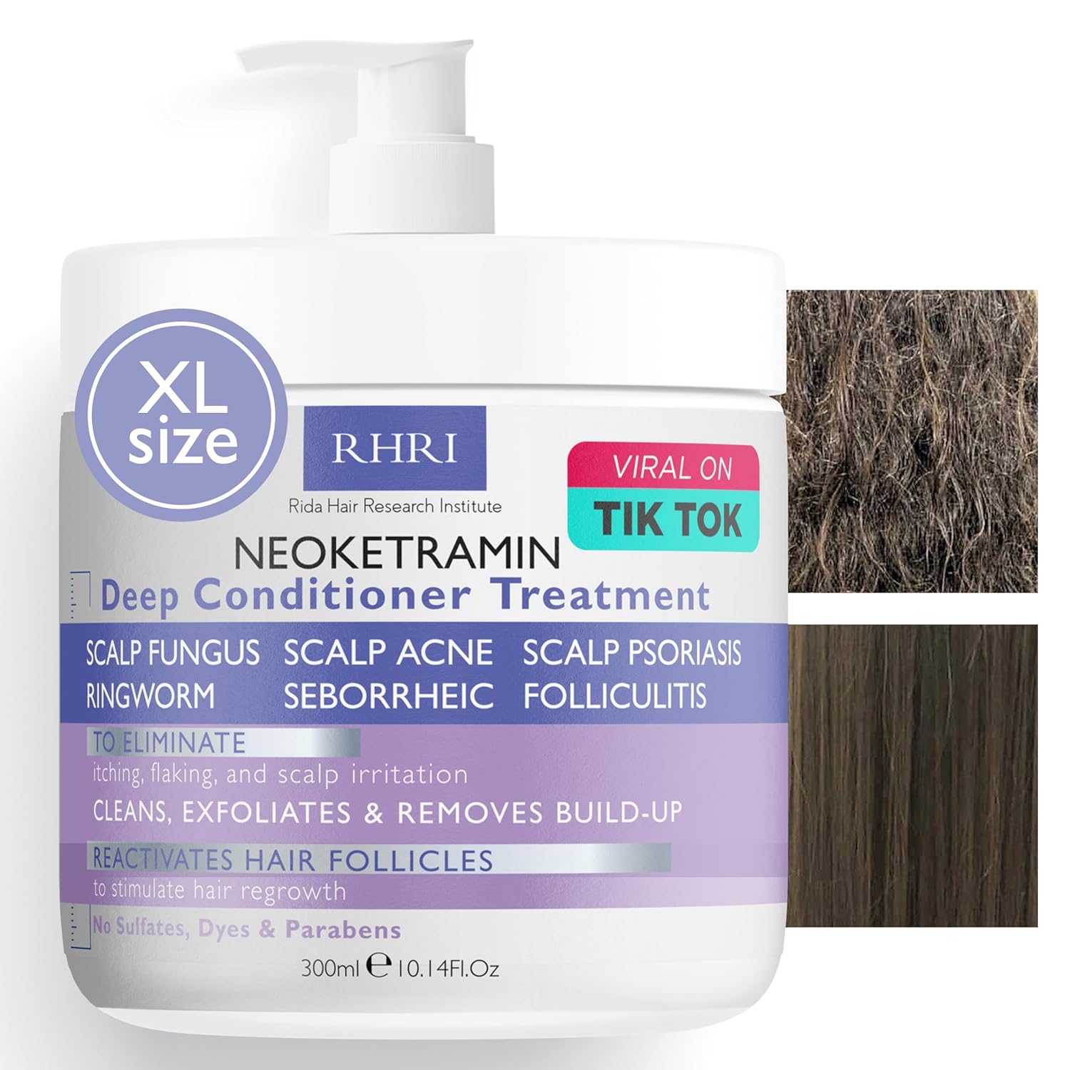 Anti Fungal Deep Conditioner for Men and Women | Scalp Treatment for Psoriasis, Dandruff, Seborrheic Dermatitis | Provides Relief from Folliculitis, Eczema, Itchy, Flaky and Dry Scalp