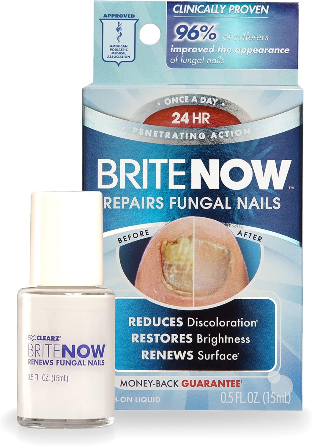 Brite Now Nail Treatment, Restores The Appearance Of Damaged & Discolored Nails, Peel-Away Technology, Brightening & Smoothing Nail Repair, 0.5 Ounce