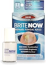 Brite Now Nail Treatment, Restores The Appearance Of Damaged & Discolored Nails, Peel-Away Technology, Brightening & Smoothing Nail Repair, 0.5 Ounce