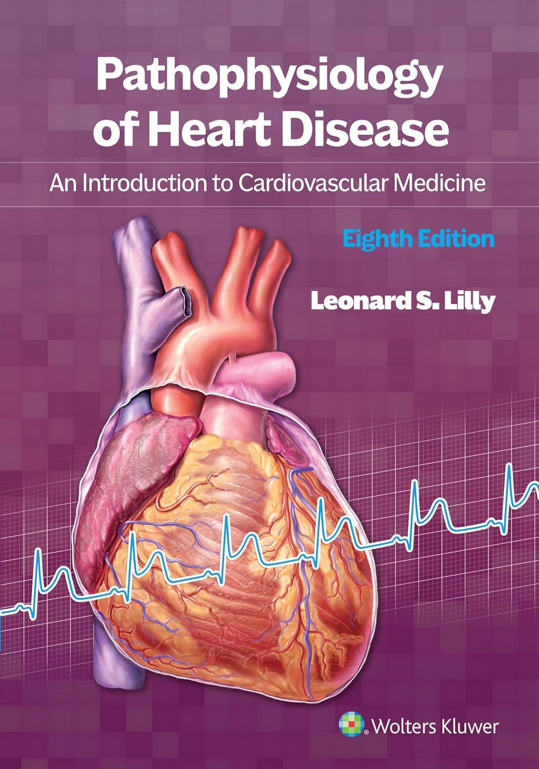 Pathophysiology of Heart Disease: An Introduction to Cardiovascular Medicine